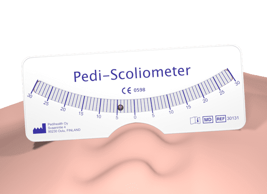 Pedi-Scoliometer